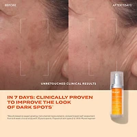 Rapid Dark Spot Correcting Serum with Glycolic and Tranexamic Acid