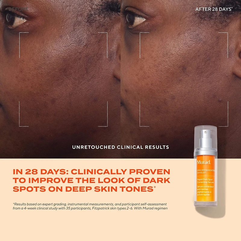 Rapid Dark Spot Correcting Serum with Glycolic and Tranexamic Acid