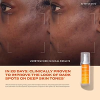 Rapid Dark Spot Correcting Serum with Glycolic and Tranexamic Acid