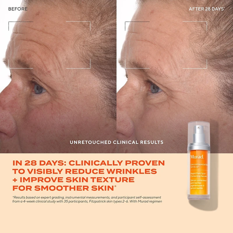 Rapid Dark Spot Correcting Serum with Glycolic and Tranexamic Acid
