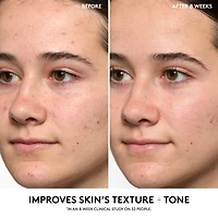 Hydra Vizor Refillable Invisible Face Moisturizer SPF 30 with Niacinamide