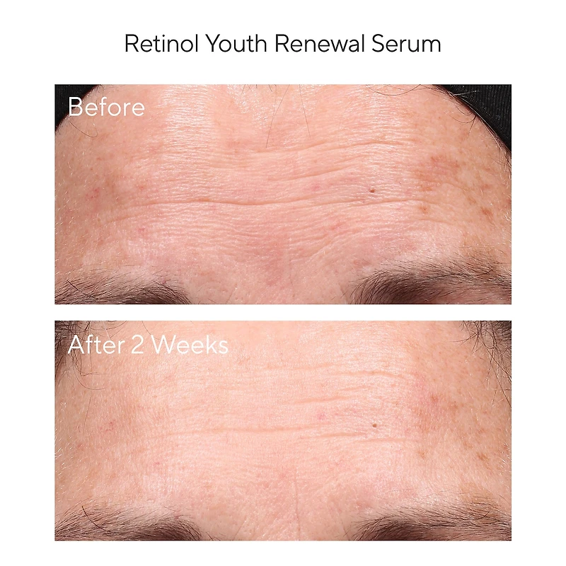Sérum rénovateur Retinol Youth