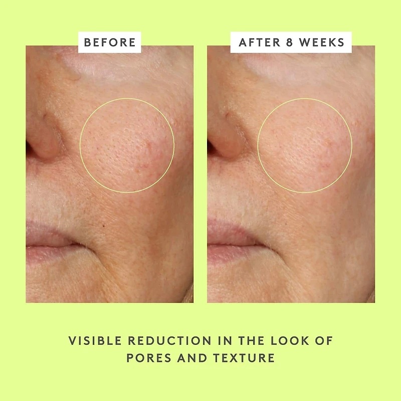 T.L.C. Framboos™ Glycolic Resurfacing Night Serum