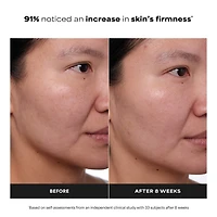 CLINICAL Anti-Aging 1% Retinol Treatment