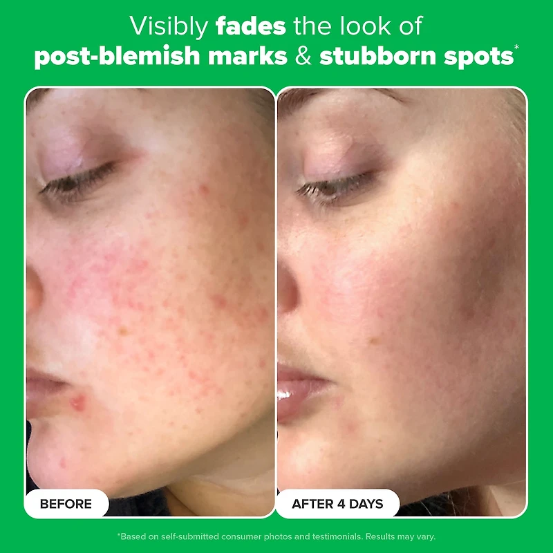 10% Azelaic Acid Booster for Redness Relief