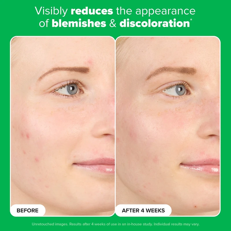 10% Azelaic Acid Booster for Redness Relief