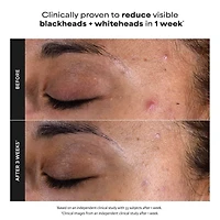 Mini Skin Perfecting 2% BHA Exfoliating Toner for Clear Skin