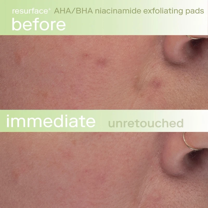 Resurface+ AHA/BHA Niacinamide Exfoliating Pads for Face and Targeted Body