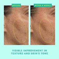 Sérum lissant aux peptides puissants Protini™ avec acide lactique