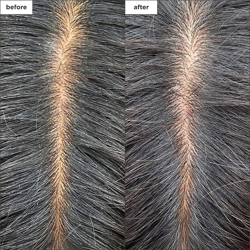 Masque hydratant et rafraîchissant pour le cuir chevelu au charbon et au théier Scalp Revival™ pour cuir chevelu sec et irrité