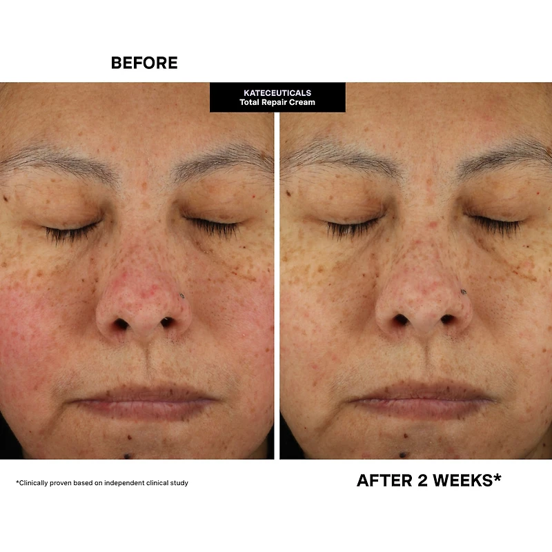 KateCeuticals® Total Repair Cream						