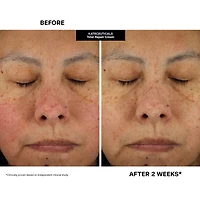 KateCeuticals® Total Repair Cream						