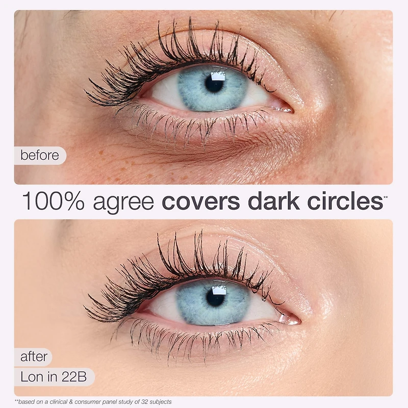 Anticernes Shape Tape™