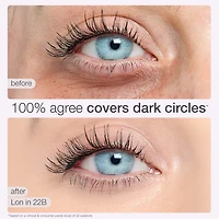 Anticernes Shape Tape™