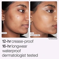 Anticernes Shape Tape™