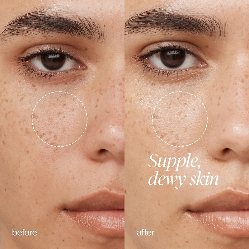 Rose & Hyaluronic Acid Deep Hydration Moisturizer