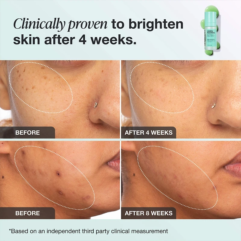 Green Machine Vitamin C Dark Spot & Hyperpigmentation Serum