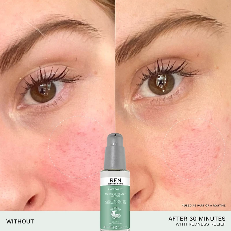 Evercalm™ Redness Relief Serum