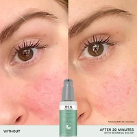 Evercalm™ Redness Relief Serum