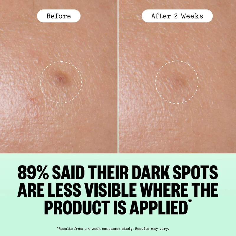 Microneedling Targeted Dark Spot Brightening Dots for Uneven Tone and Texture