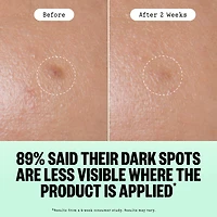 Microneedling Targeted Dark Spot Brightening Dots for Uneven Tone and Texture
