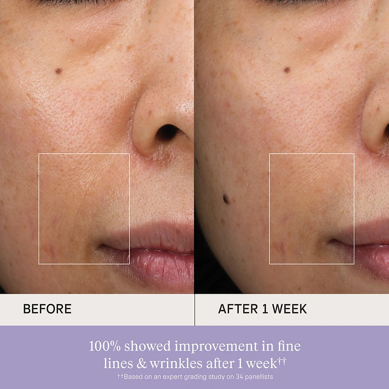 The Essence Skincare Boosting Treatment