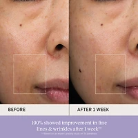 The Essence Skincare Boosting Treatment