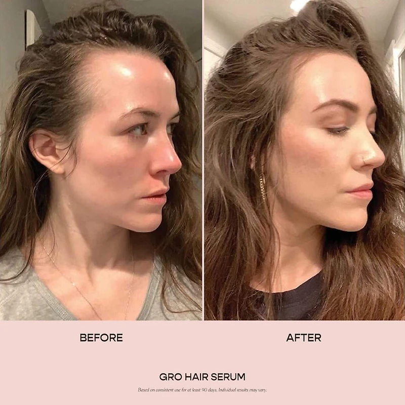 GRO Hair Serum for Thinning