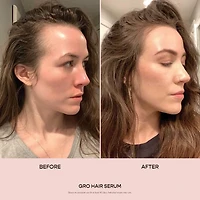 GRO Hair Serum for Thinning