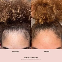 GRO Hair Serum for Thinning