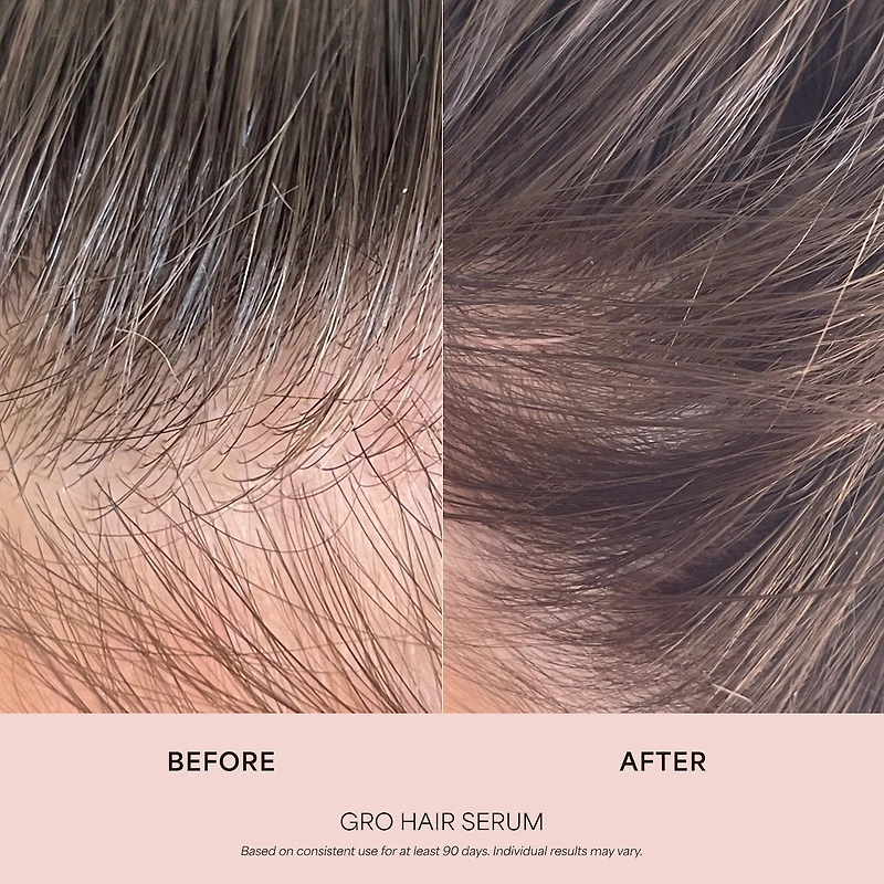 GRO Hair Serum for Thinning