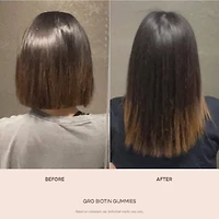 GRO Hair Serum & Biotin Gummies Set for Thinning Hair