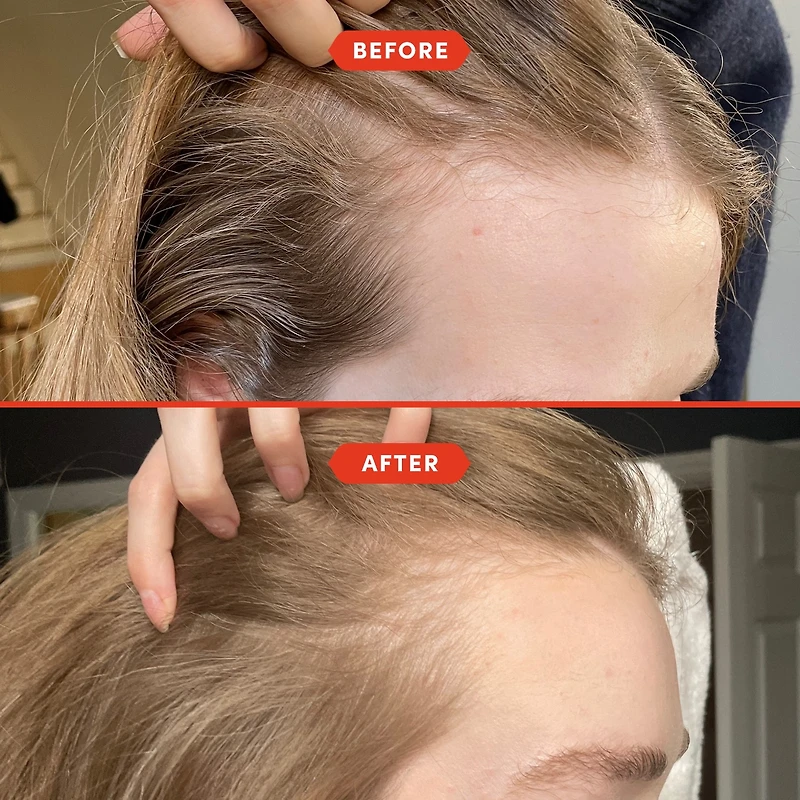 Huile de prélavage HoliRoots™ pour cheveux fins