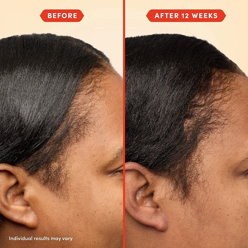 Huile de prélavage HoliRoots™ pour cheveux fins
