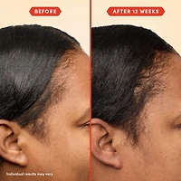 Huile de prélavage HoliRoots™ pour cheveux fins