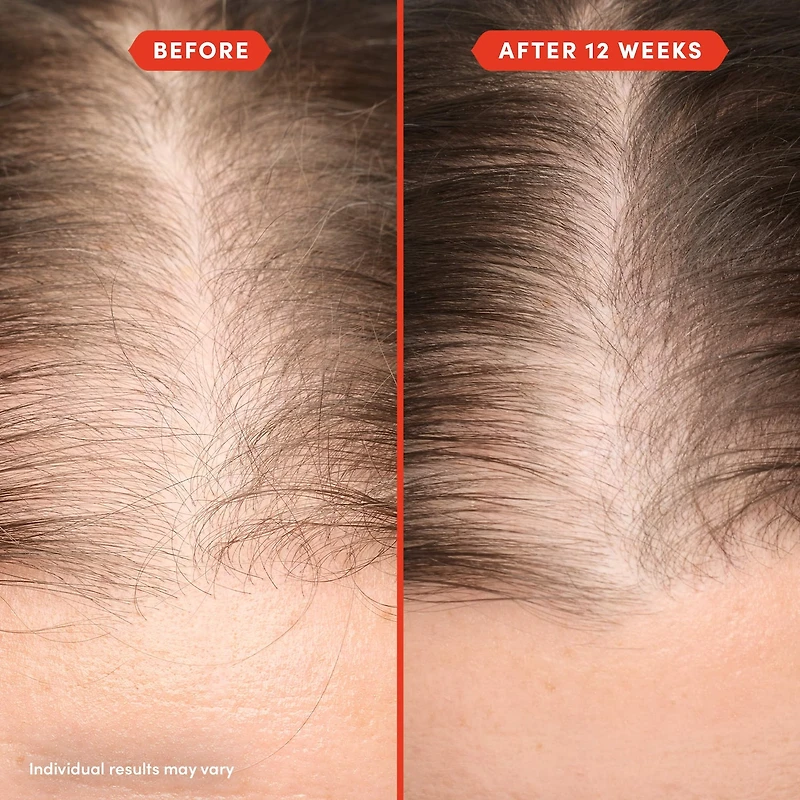 Huile de prélavage HoliRoots™ pour cheveux fins