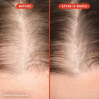 Huile de prélavage HoliRoots™ pour cheveux fins
