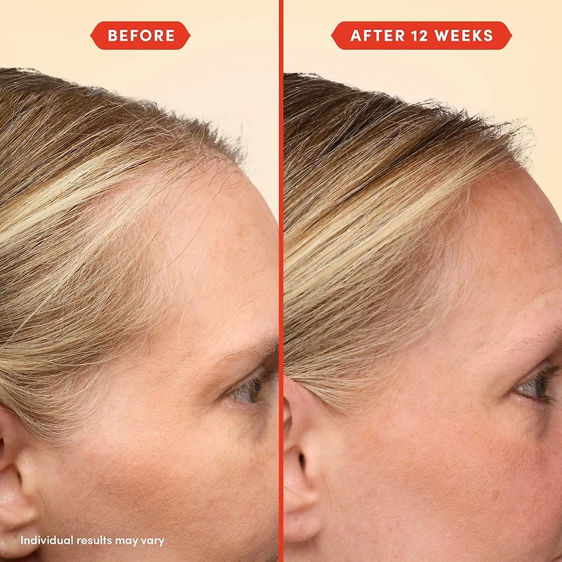Huile de prélavage HoliRoots™ pour cheveux fins
