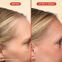 Huile de prélavage HoliRoots™ pour cheveux fins