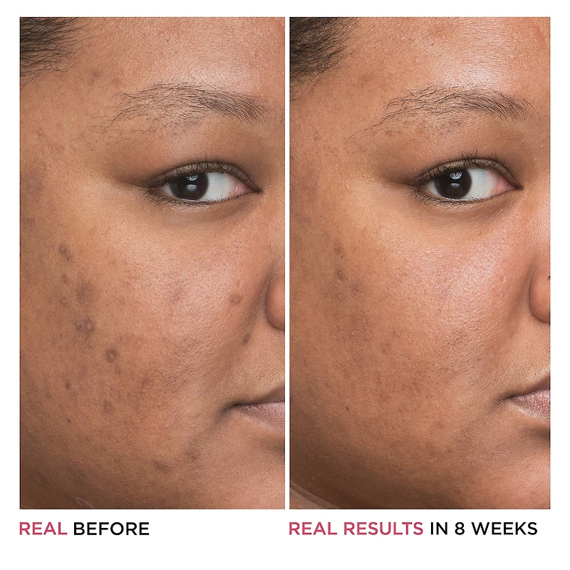 Sérum de niacinamide 4 % Bye Bye Dark Spots