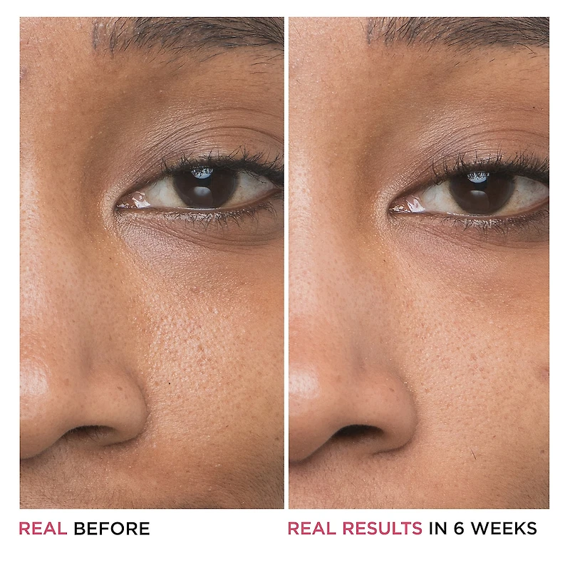 Sérum à 10 % d’acide glycolique Bye Bye Pores