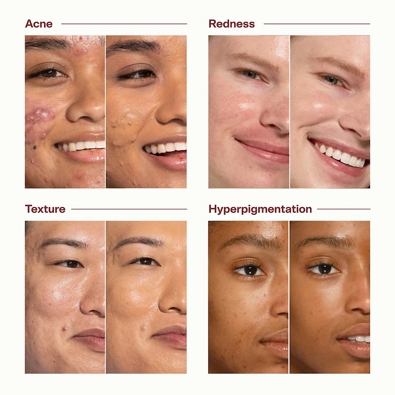 SunnyDays Skin Tint with Mineral Zinc SPF 30