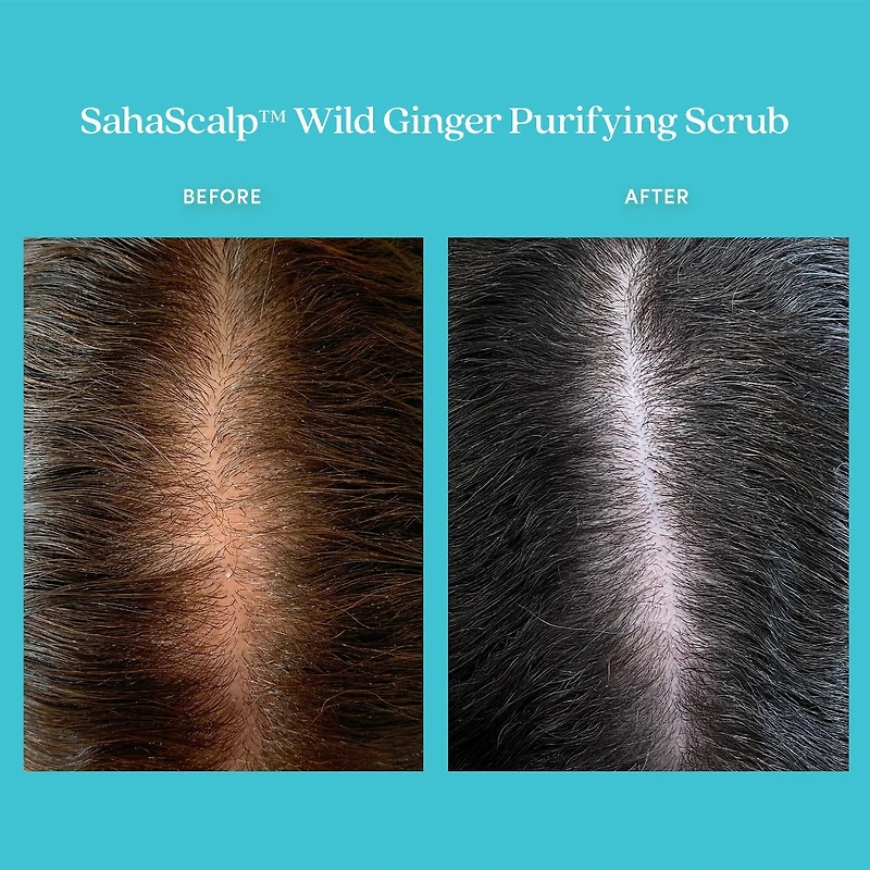 Exfoliant purifiant au gingembre sauvage SahaScalp