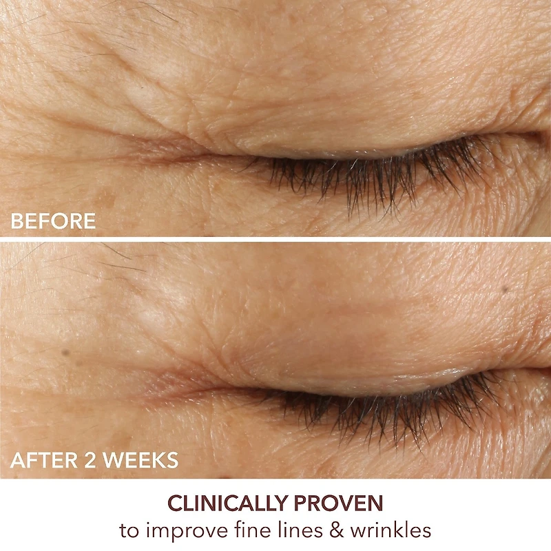 Sérum contour des yeux Triple correction Advanced Retinol + Ferulic