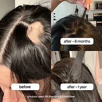 Shampoing HG au romarin pour cheveux clairsemés