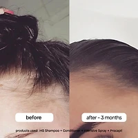Vaporisateur quotidien intensif avec romarin pour cheveux clairsemés
