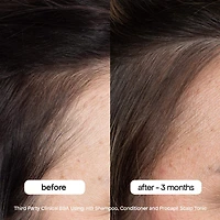 Lotion tonique pour cheveux et cuir chevelu Procapil pour éclaircir les cheveux avec extrait de prêle
