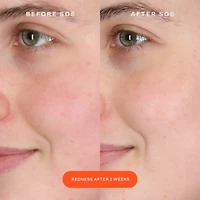 Sérum intensif Anti-Rougeurs SOS avec acide hypochloreux
