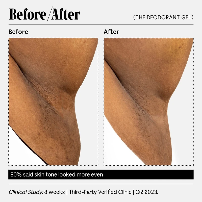 The Deodorant Gel - With 5% Alpha Hydroxy Acid (AHA) and Niacinamide