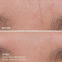 Get That Glow - GloPRO® Microneedling Tool & Discovery Set